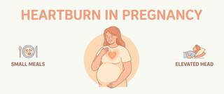 Heartburn in Pregnancy: Causes and How to Relieve It