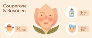 Couperose and Rosacea: Care, Triggers and What to Look For