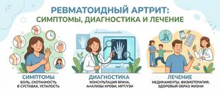 Ревматоидный артрит: симптомы, диагностика и лечение