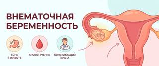 Внематочная беременность: признаки, симптомы и роль ХГЧ