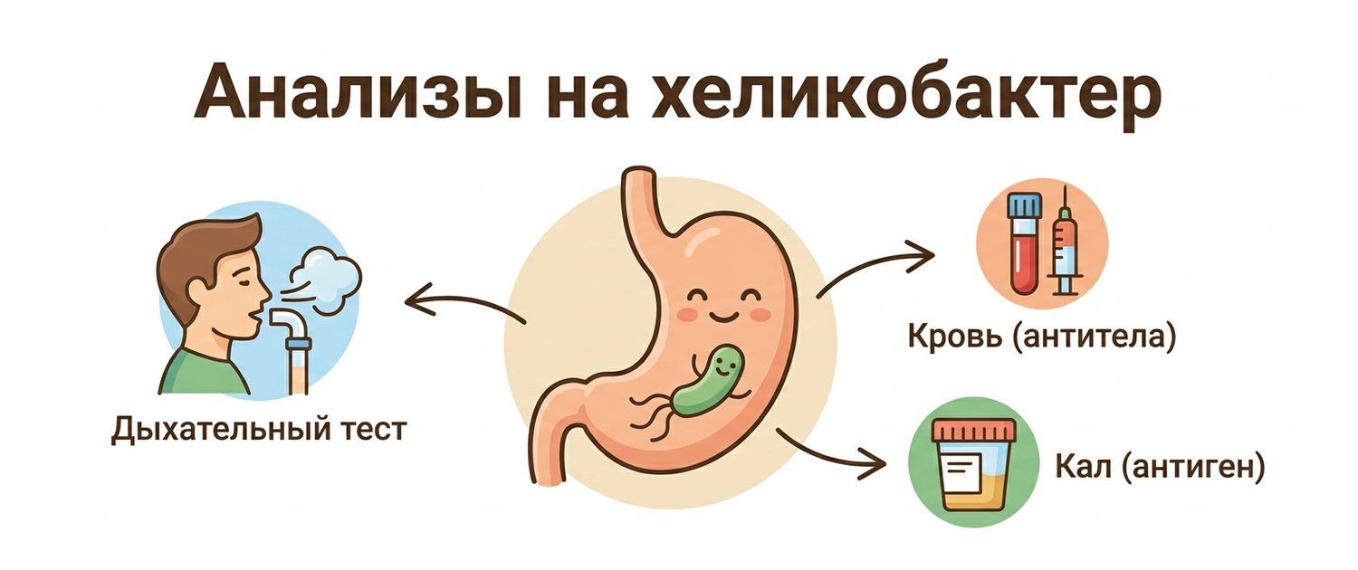 Анализы на хеликобактер: какие сдавать и как подготовиться