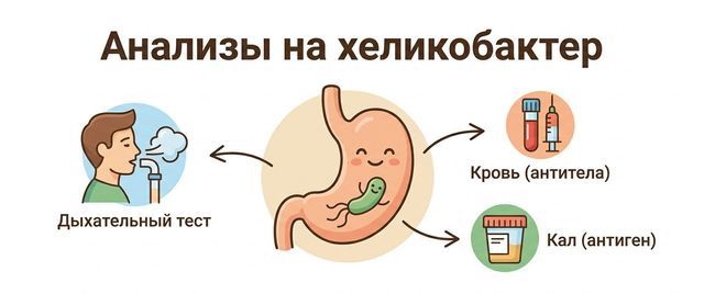Анализы на хеликобактер: какие сдавать и как подготовиться