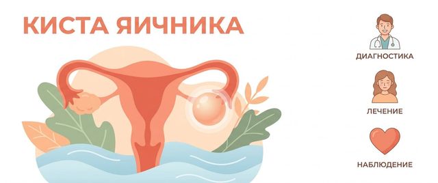 Киста яичника: виды, симптомы, размеры и УЗИ малого таза